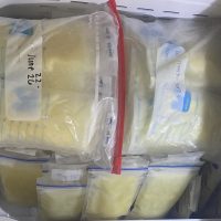 Surplus of breast milk
