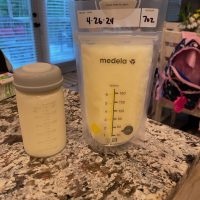 Oversupply of breast milk