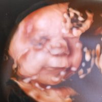 In need for baby coming soon.
